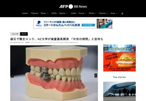 【6月29日 AFP】磁石で患者の顎を固定する減量器具が、ニュージーランドで開発された。