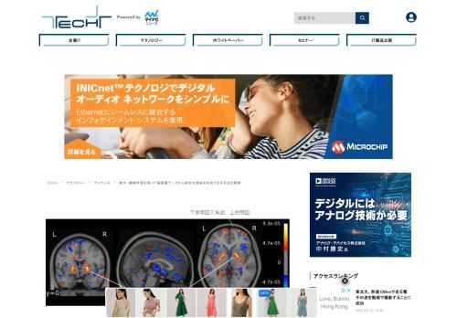 東京大学は3月29日、慢性期統合失調症および健常対照者から計測された複数のMRI画像の脳構造画像データセットを用いて機械学習を行い、70%以上を判別可能な機械学習器を開発したことを発表した。